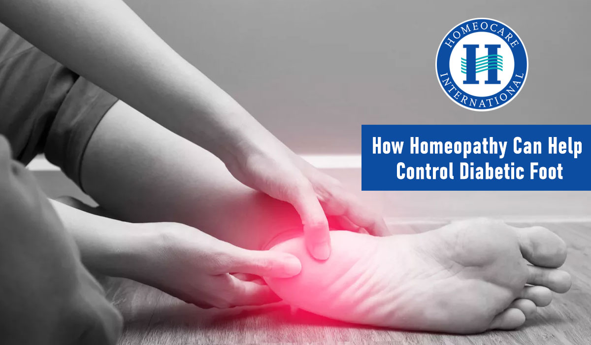 How homeopathy can help control Diabetic foot